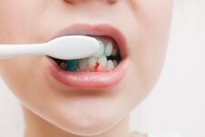 Gums-Bleeding-While-Brushing-or-Flossing.jpg