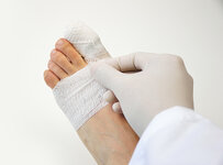 orthoatlanta_symptoms_and_treatment_of_a_fractured_toe_image_1.jpg